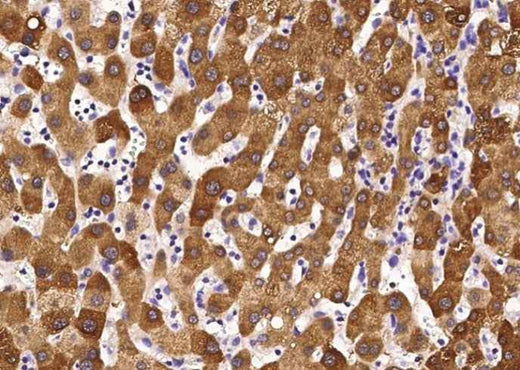 Anti-Human GOT2 Antibody [A919] - ABMIUM