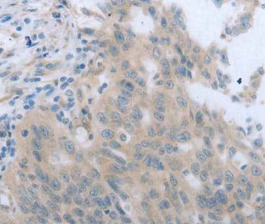 Anti-Human/Mouse/Rat TNK2 Antibody