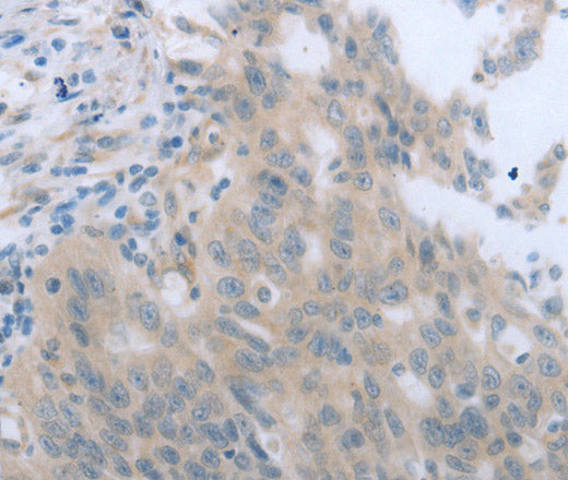 Anti-Human/Mouse/Rat TNK2 Antibody - ABMIUM