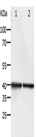 Anti-Human/Mouse/Rat PDX1 Antibody - ABMIUM