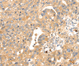 Anti-Human S100A12 Antibody - ABMIUM