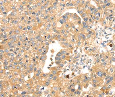 Anti-Human S100A12 Antibody