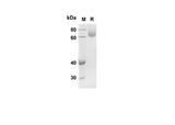 SDS-PAGE analysis of Human DCN SLRR1B proteins, 2 μg/lane of Recombinant Human DCN SLRR1B proteins was resolved with SDS-PAGE under reducing conditions, showing bands at 61 kDa.