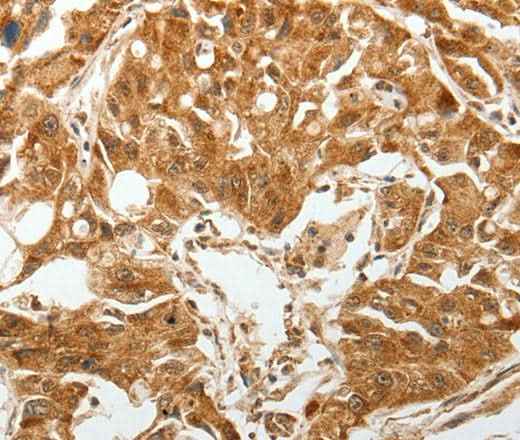 Anti-Human/Mouse/Rat TGFBR1 Antibody