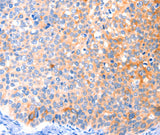 Anti-Human/Mouse CCDC88A Antibody - ABMIUM