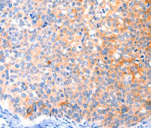 Anti-Human/Mouse CCDC88A Antibody