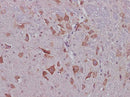 Anti-Mouse CNTF Antibody - ABMIUM