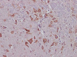 Anti-Mouse CNTF Antibody - ABMIUM
