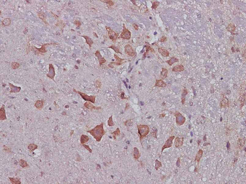 Anti-Mouse CNTF Antibody - ABMIUM