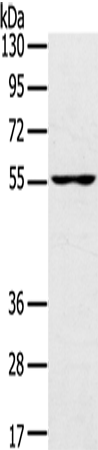 Anti-Human/Mouse UBP1 Antibody - ABMIUM