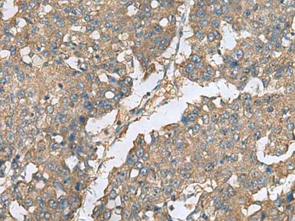Anti-Human/Mouse EIF1AX Antibody