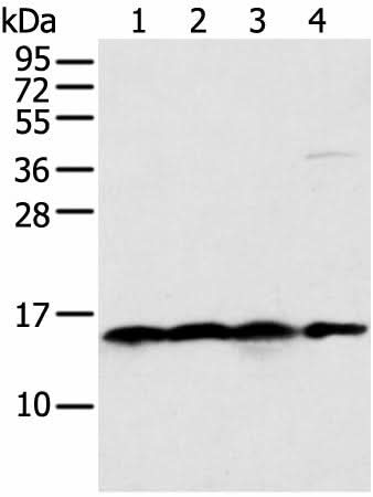 Western blot analysis of 231 Hela K562 cell and Human bladder carcinoma tissue using MRPS18C Polyclonal Antibody at dilution of 1:400