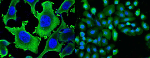 Anti-Human HSPB1 Antibody [B247] - ABMIUM