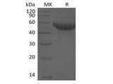 Recombinant Human Siglec-8 (C-6His) - ABMIUM