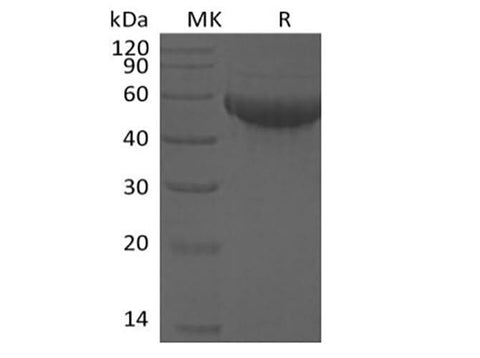 Recombinant Human Siglec-8 (C-6His) - ABMIUM