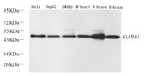 Western Blot analysis of various samples using GAP43 Polyclonal Antibody at dilution of 1:2000.