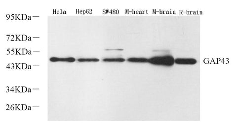 Western Blot analysis of various samples using GAP43 Polyclonal Antibody at dilution of 1:2000.