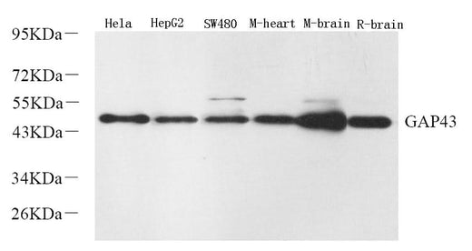 Western Blot analysis of various samples using GAP43 Polyclonal Antibody at dilution of 1:2000.