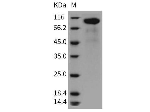> 92 % as determined by reducing SDS-PAGE.