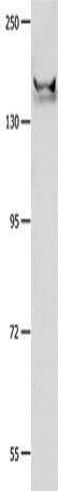 Anti-Human/Mouse/Rat GRIN2B Antibody - ABMIUM