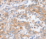 Anti-Human/Mouse PPOX Antibody - ABMIUM