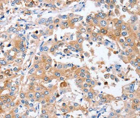 Anti-Human/Mouse PPOX Antibody