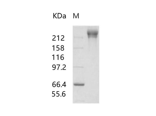 Recombinant HIV-1 gp140 Protein (group M, subtype CRF07_BC) (Fc Tag) - ABMIUM