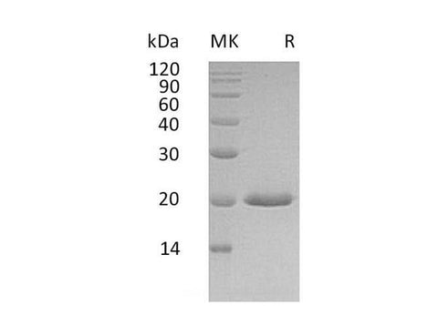 Recombinant Human IFNA4 Protein (His Tag) - ABMIUM
