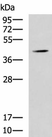 Western blot analysis of Mouse liver tissue lysate using SPI1 Polyclonal Antibody at dilution of 1:1600