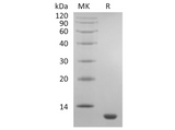 Recombinant Human CCL11/Eotaxin Protein - ABMIUM