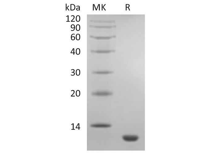 Recombinant Human CCL11/Eotaxin Protein - ABMIUM