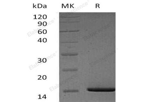 Recombinant Human Serum Amyloid A1/SAA1 Protein (His Tag) - ABMIUM