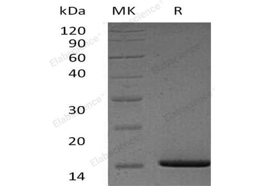 Recombinant Human Serum Amyloid A1/SAA1 Protein (His Tag) - ABMIUM