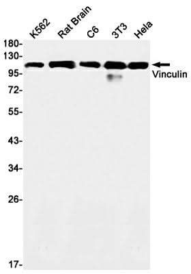 Western blot detection of Vinculin in K562,Rat Brain,C6,3T3,Hela cell lysates using Vinculin Rabbit mAb(1:1000 diluted).Predicted band size:124kDa.Observed band size:124kDa.