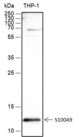 Anti-Human S100A9 Antibody [A450]