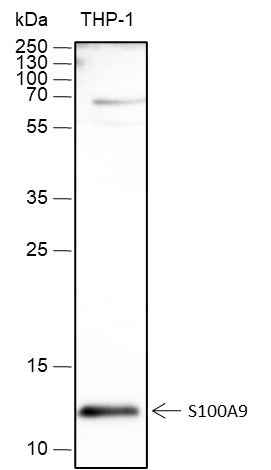 Anti-Human S100A9 Antibody [A450] - ABMIUM
