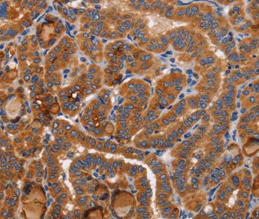 Anti-Human/Rat BMP6 Antibody