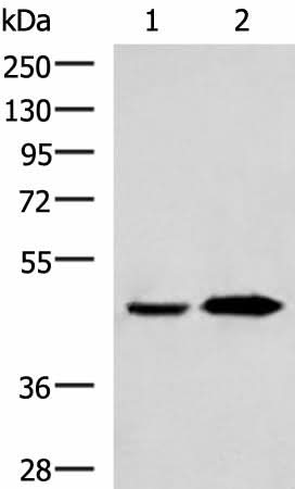 Western blot analysis of Human fetal liver tissue and Human liver tissue lysates using BHMT2 Polyclonal Antibody at dilution of 1:800