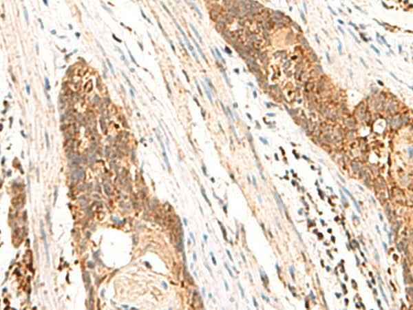 Anti-Human/Mouse CYYR1 Antibody