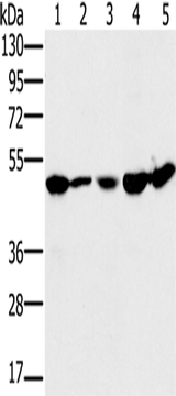 Anti-Human/Mouse/Rat PSMC2 Antibody - ABMIUM