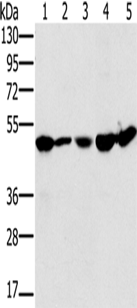 Anti-Human/Mouse/Rat PSMC2 Antibody - ABMIUM