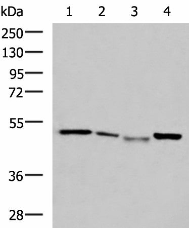 Western blot analysis of HepG2 cell Hela cell Mouse kidney tissue K562 cell lysates using NFS1 Polyclonal Antibody at dilution of 1:800