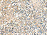 Immunohistochemistry of paraffin-embedded Human tonsil tissue using GPR157 Polyclonal Antibody at dilution of 1:50(×200)