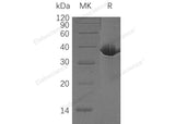 Recombinant Human MDH1 Protein (His Tag) - ABMIUM