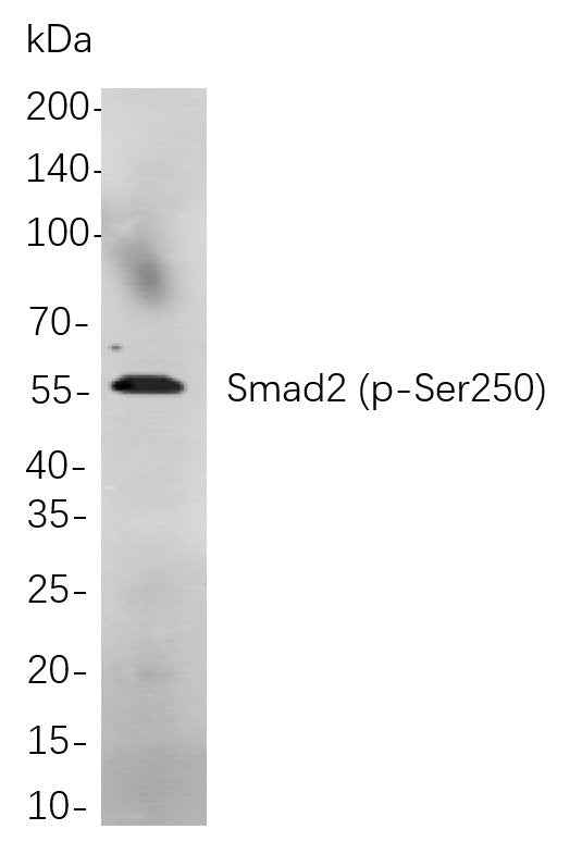 Anti-Human/Mouse/Rat Smad2 Antibody [B711] - ABMIUM