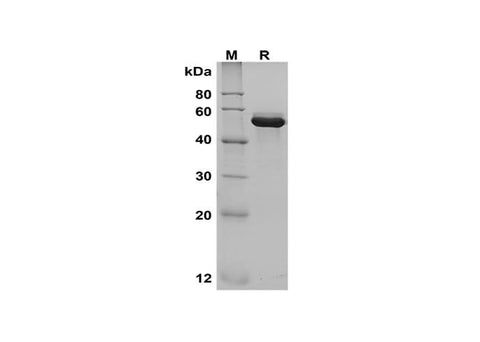 SDS-PAGE analysis of Mouse Lcn2 proteins, 2 μg/lane of Recombinant Mouse Lcn2 proteins, was resolved with SDS-PAGE under reducing conditions, showing bands at 53 kDa.
