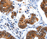 Anti-Human GSK3A Antibody - ABMIUM