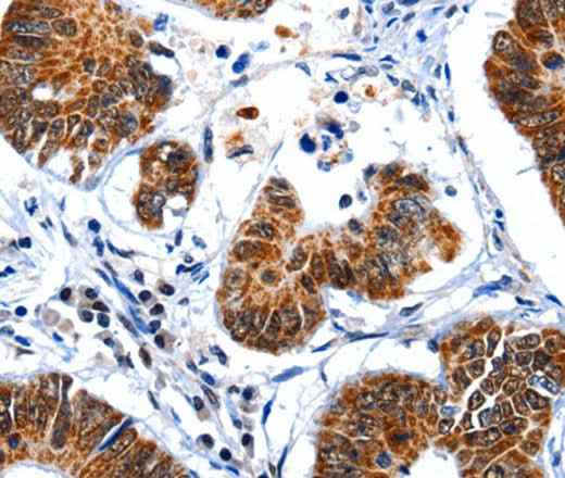 Anti-Human GSK3A Antibody