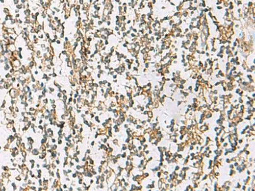 Anti-Human ZPBP2 Antibody