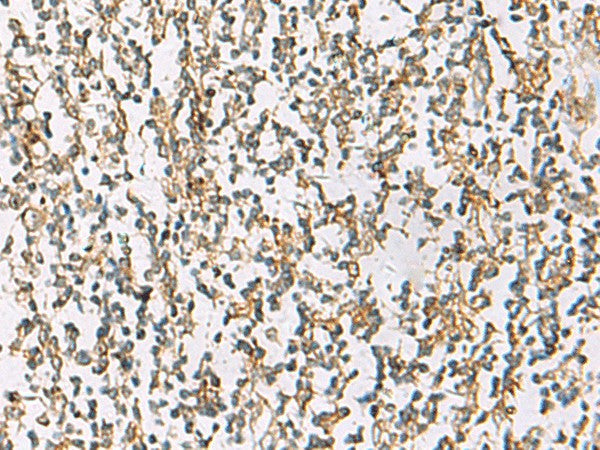 Immunohistochemistry of paraffin-embedded Human tonsil tissue using ZPBP2 Polyclonal Antibody at dilution of 1:80(×200)